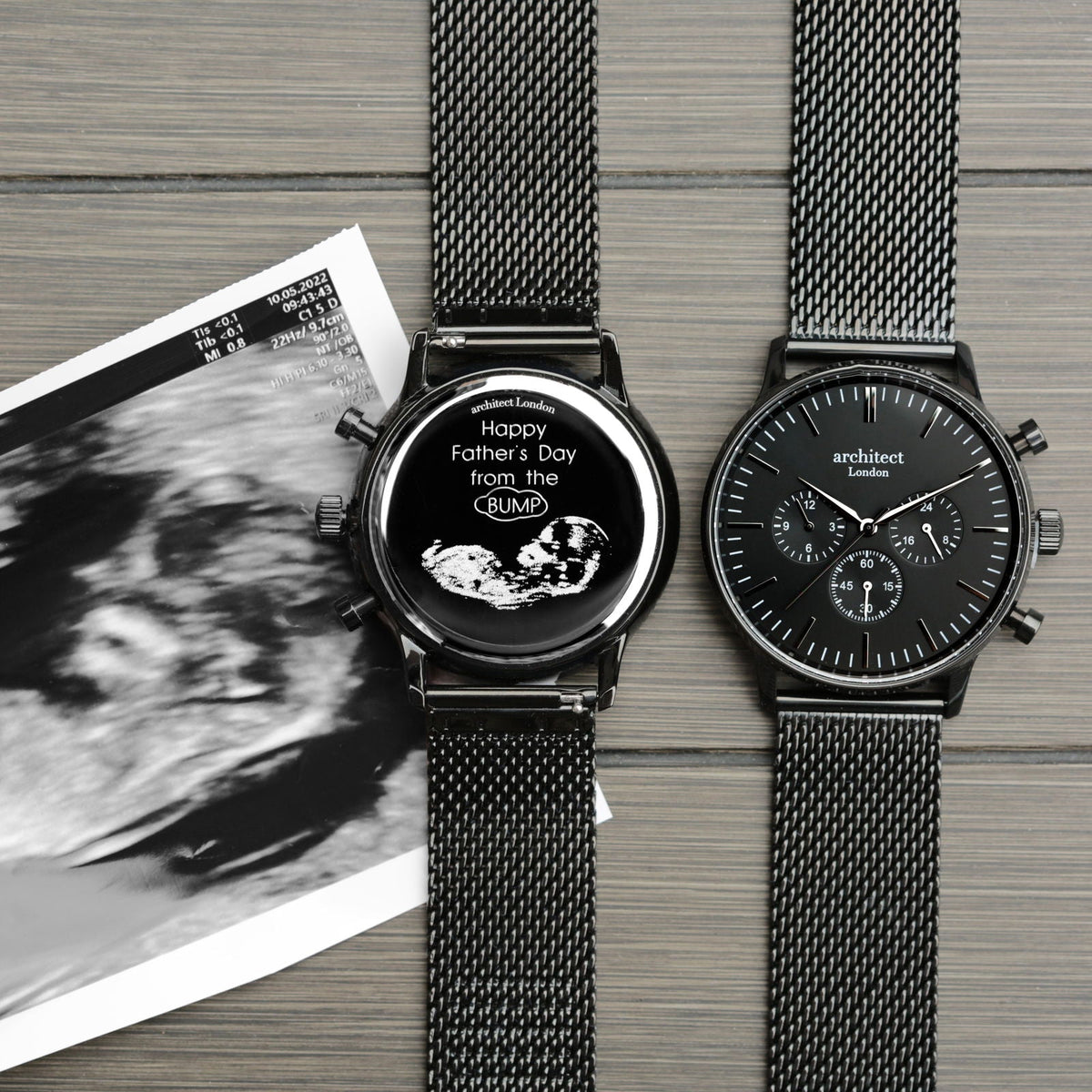 Personalized mesh watch with an ultrasound photo engarved-on-the-watch-case-base